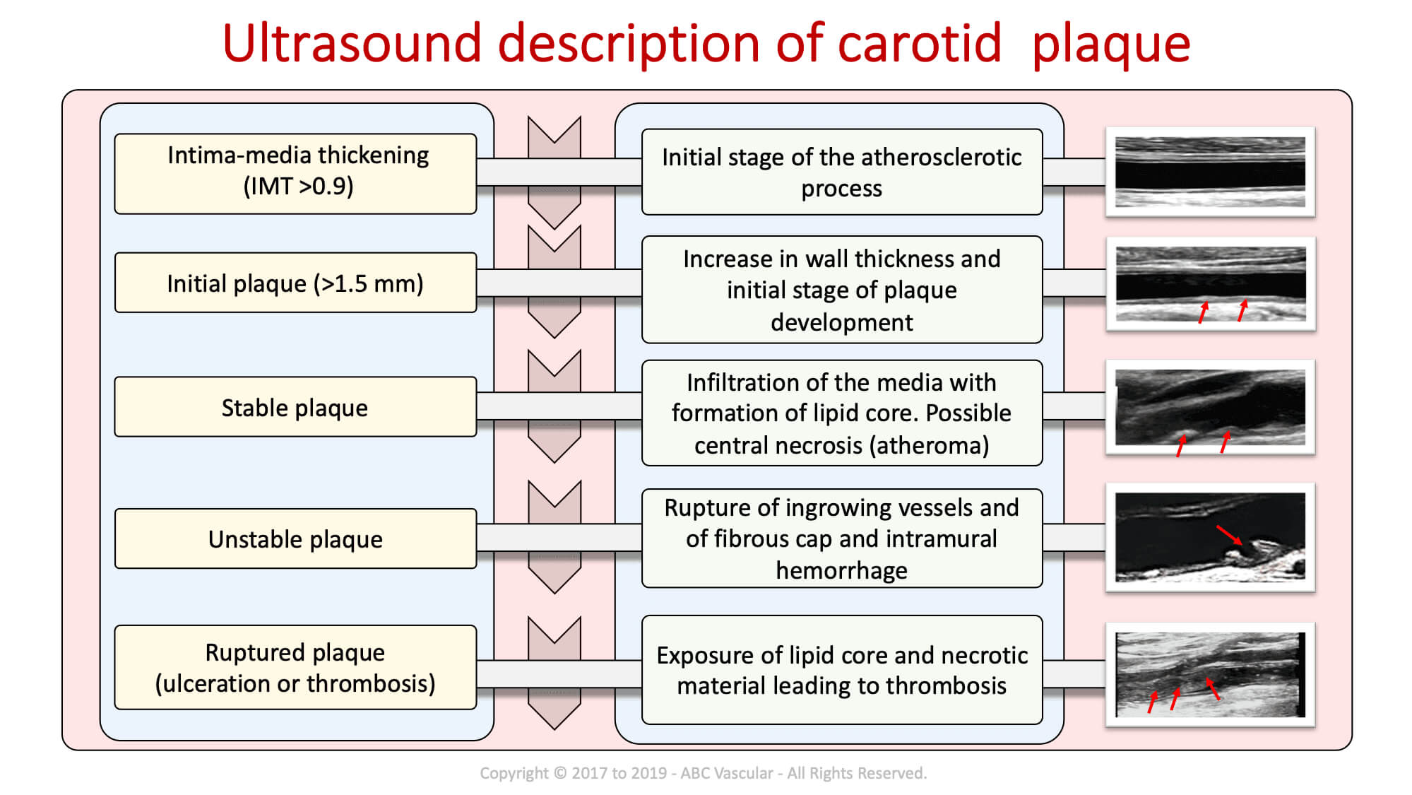 Carotid Course Info | Abc Vascular With Regard To Carotid Ultrasound Report Template